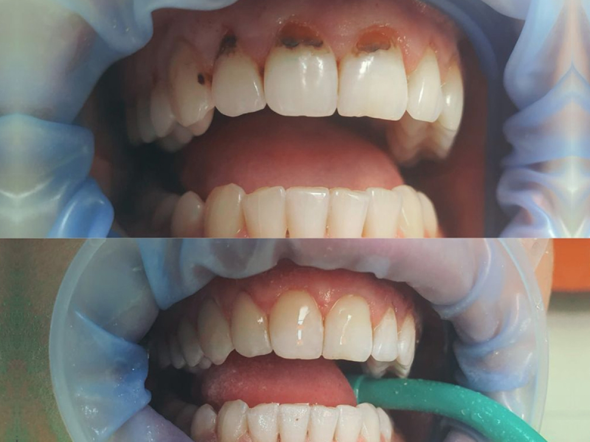 Piękny uśmiech dzięki Ventura Similux